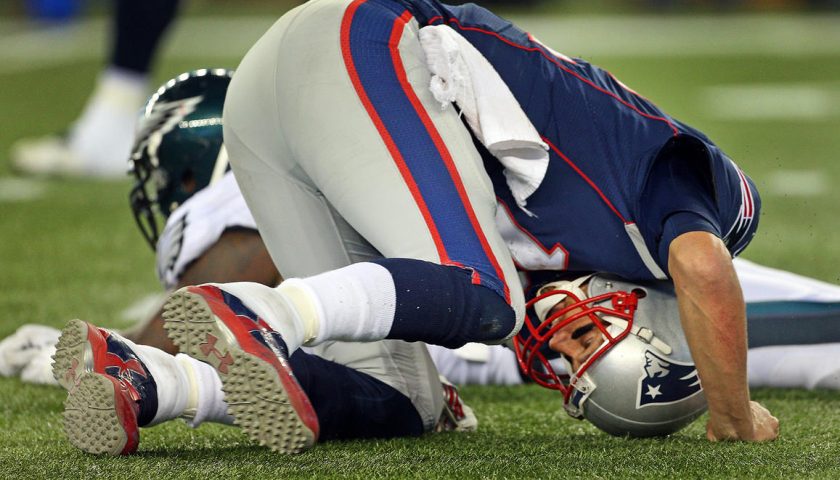 Tom Brady Concussion